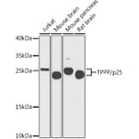 Western Blot - Anti-TPPP Antibody (A16238) - Antibodies.com