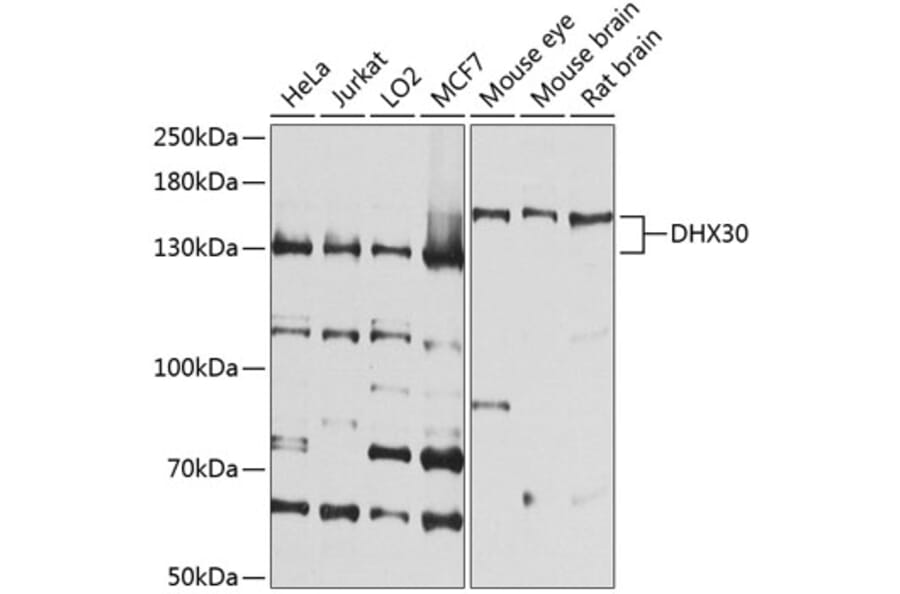 Western Blot - Anti-DHX30 Antibody (A16239) - Antibodies.com