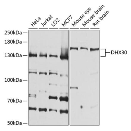 Western Blot - Anti-DHX30 Antibody (A16239) - Antibodies.com