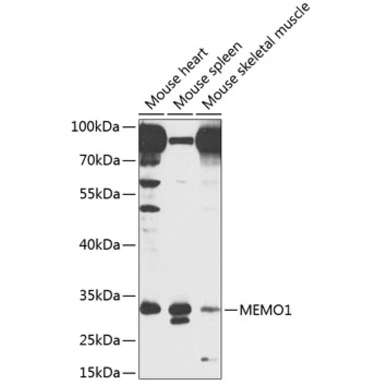 Western Blot - Anti-MEMO1 Antibody (A8582) - Antibodies.com