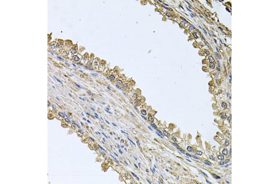 Immunohistochemistry - Anti-MEMO1 Antibody (A8582) - Antibodies.com
