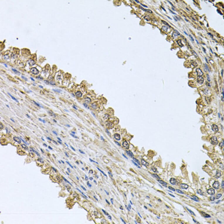 Immunohistochemistry - Anti-MEMO1 Antibody (A8582) - Antibodies.com