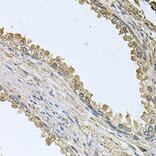 Immunohistochemistry - Anti-MEMO1 Antibody (A8582) - Antibodies.com