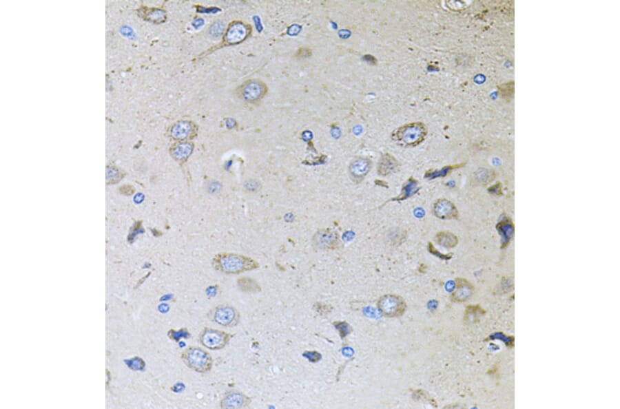 Immunohistochemistry - Anti-MEMO1 Antibody (A8582) - Antibodies.com