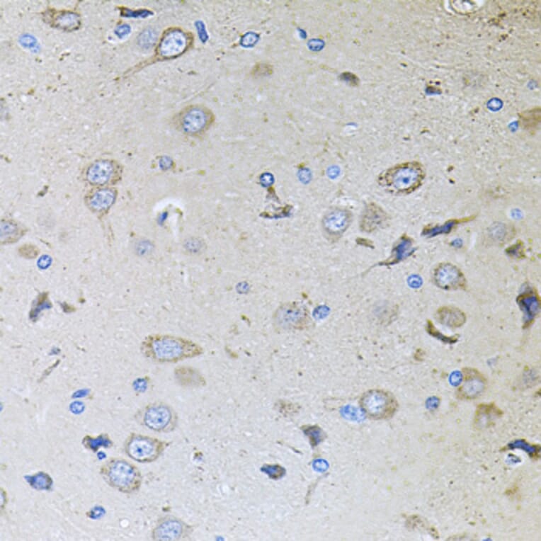 Immunohistochemistry - Anti-MEMO1 Antibody (A8582) - Antibodies.com