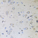 Immunohistochemistry - Anti-MEMO1 Antibody (A8582) - Antibodies.com