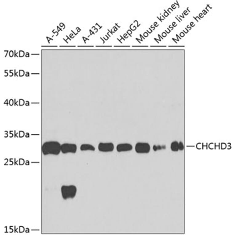 Western Blot - Anti-MIC19 Antibody (A16241) - Antibodies.com