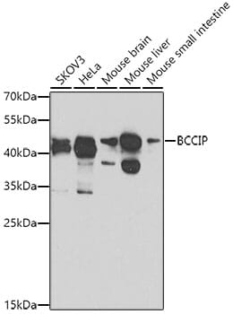 Western blot analysis of extracts of various cell lines, using Anti-BCCIP Antibody (A8586) at 1:1,000 dilution.
Secondary antibody: Goat Anti-Rabbit IgG (H+L) (HRP) (AS014) at 1:10,000 dilution.
Lysates / proteins: 25µg per lane.
Blocking buffer: 3% non-fat dry milk in TBST.
Detection: ECL Basic Kit (RM00020).
Exposure time: 90s.