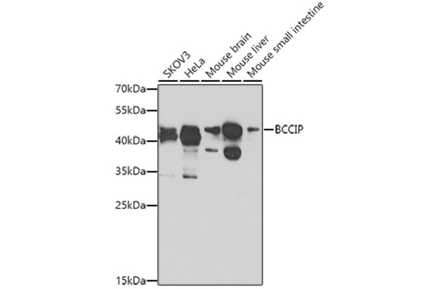 Western Blot - Anti-BCCIP Antibody (A16242) - Antibodies.com