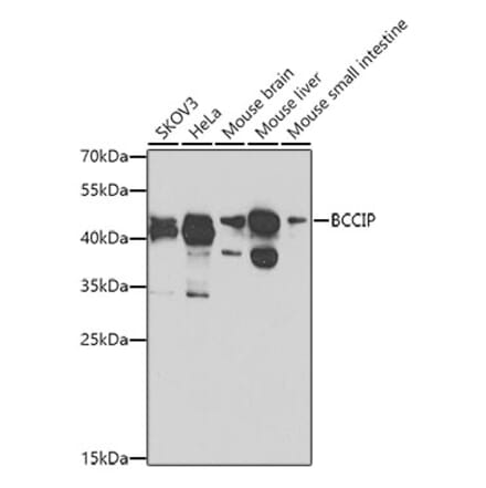 Western Blot - Anti-BCCIP Antibody (A16242) - Antibodies.com