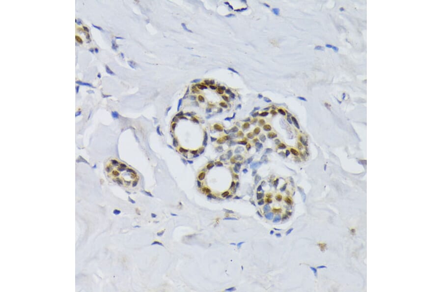 Immunohistochemistry - Anti-BCCIP Antibody (A16242) - Antibodies.com
