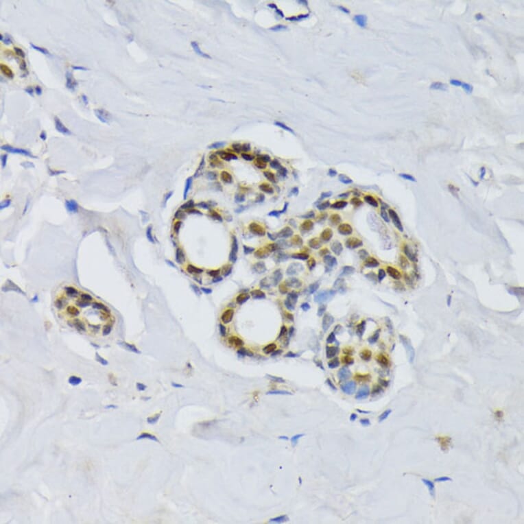 Immunohistochemistry - Anti-BCCIP Antibody (A16242) - Antibodies.com