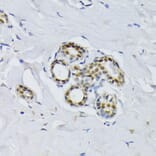 Immunohistochemistry - Anti-BCCIP Antibody (A16242) - Antibodies.com