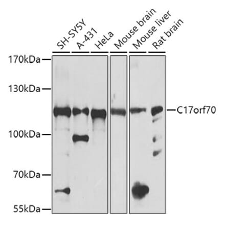 Western Blot - Anti-FP100 Antibody (A16243) - Antibodies.com