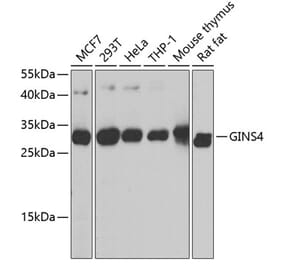 Western Blot - Anti-SLD5 Antibody (A16244) - Antibodies.com