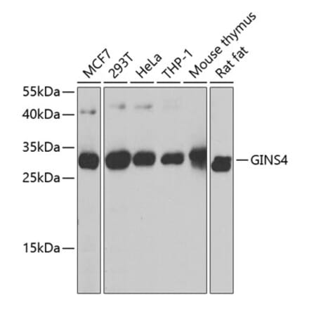 Western Blot - Anti-SLD5 Antibody (A16244) - Antibodies.com