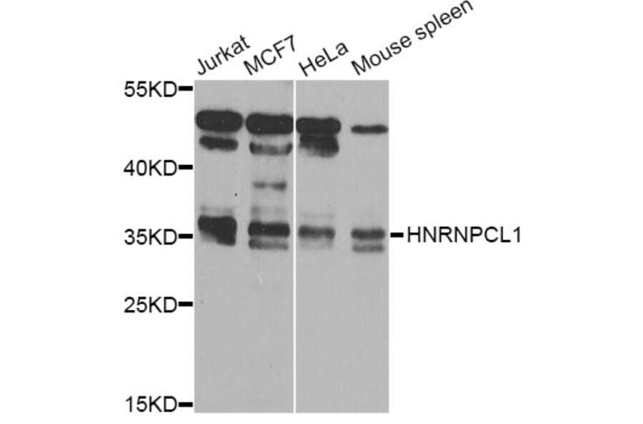 Western Blot - Anti-HNRNPCL1 Antibody (A8606) - Antibodies.com