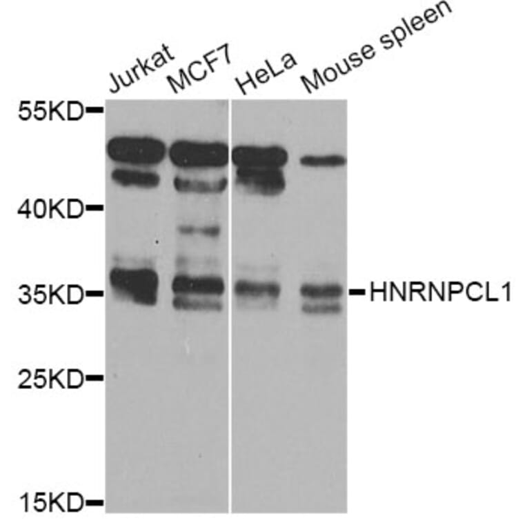 Western Blot - Anti-HNRNPCL1 Antibody (A8606) - Antibodies.com
