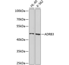 Western Blot - Anti-beta 3 Adrenergic Receptor Antibody (A16246) - Antibodies.com