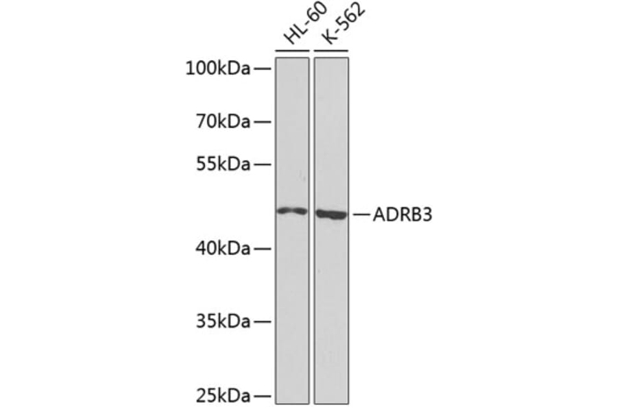 Western Blot - Anti-beta 3 Adrenergic Receptor Antibody (A16246) - Antibodies.com