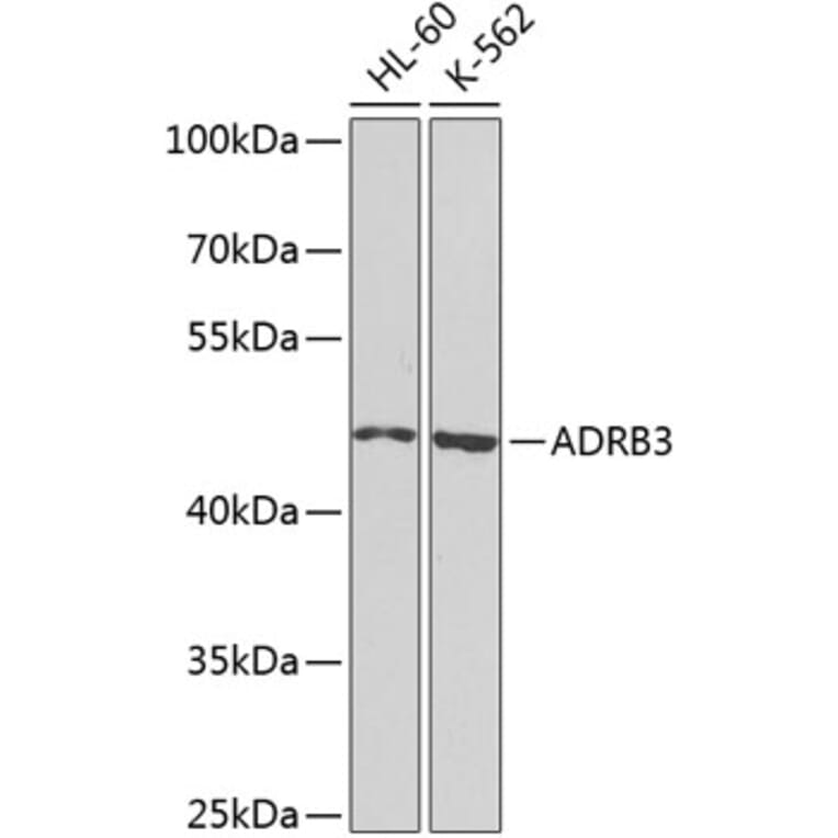 Western Blot - Anti-beta 3 Adrenergic Receptor Antibody (A16246) - Antibodies.com