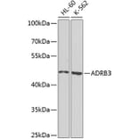 Western Blot - Anti-beta 3 Adrenergic Receptor Antibody (A16246) - Antibodies.com