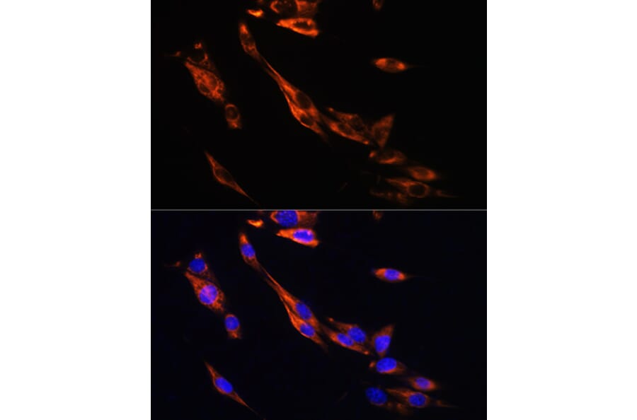Immunofluorescence - Anti-beta 3 Adrenergic Receptor Antibody (A16246) - Antibodies.com