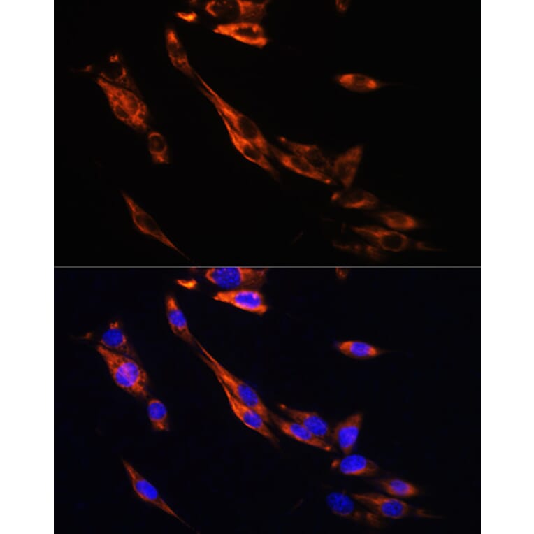 Immunofluorescence - Anti-beta 3 Adrenergic Receptor Antibody (A16246) - Antibodies.com