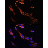 Immunofluorescence - Anti-beta 3 Adrenergic Receptor Antibody (A16246) - Antibodies.com