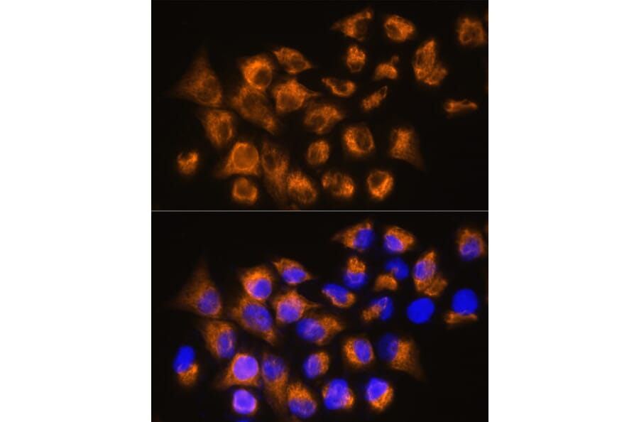Immunofluorescence - Anti-beta 3 Adrenergic Receptor Antibody (A16246) - Antibodies.com