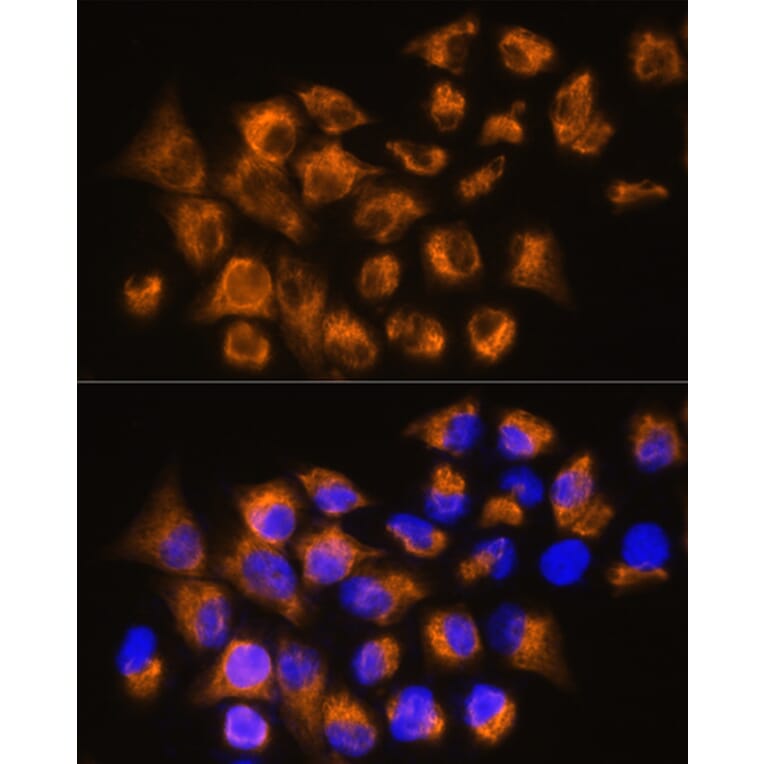 Immunofluorescence - Anti-beta 3 Adrenergic Receptor Antibody (A16246) - Antibodies.com