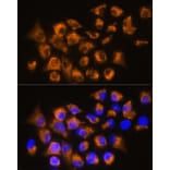 Immunofluorescence - Anti-beta 3 Adrenergic Receptor Antibody (A16246) - Antibodies.com