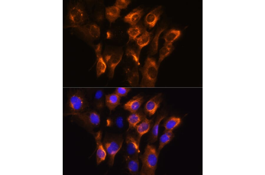 Immunofluorescence - Anti-beta 3 Adrenergic Receptor Antibody (A16246) - Antibodies.com