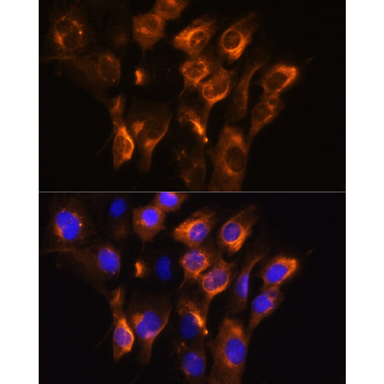 Immunofluorescence - Anti-beta 3 Adrenergic Receptor Antibody (A16246) - Antibodies.com