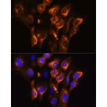 Immunofluorescence - Anti-beta 3 Adrenergic Receptor Antibody (A16246) - Antibodies.com