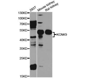 Western Blot - Anti-KCNK9 Antibody (A8609) - Antibodies.com