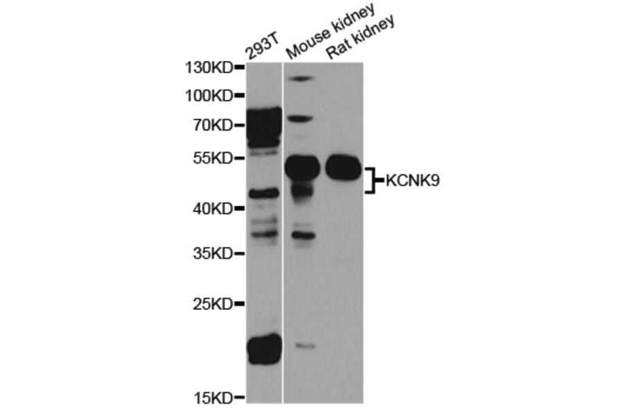 Western Blot - Anti-KCNK9 Antibody (A8609) - Antibodies.com