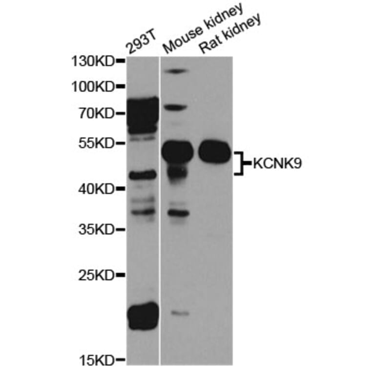 Western Blot - Anti-KCNK9 Antibody (A8609) - Antibodies.com