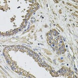 Immunohistochemistry - Anti-KCNK9 Antibody (A8609) - Antibodies.com