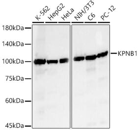 Western Blot - Anti-KPNB1 Antibody (A16248) - Antibodies.com