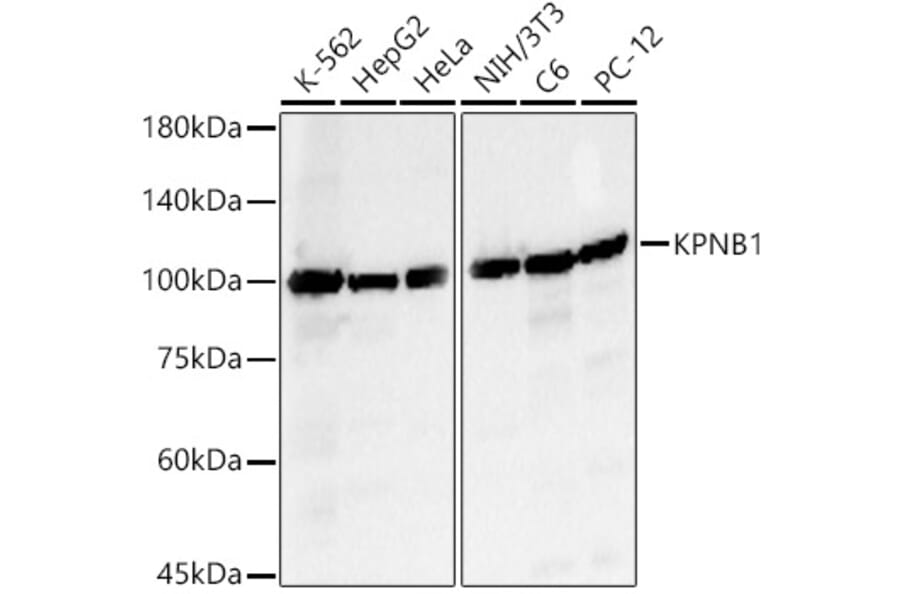 Western Blot - Anti-KPNB1 Antibody (A16248) - Antibodies.com