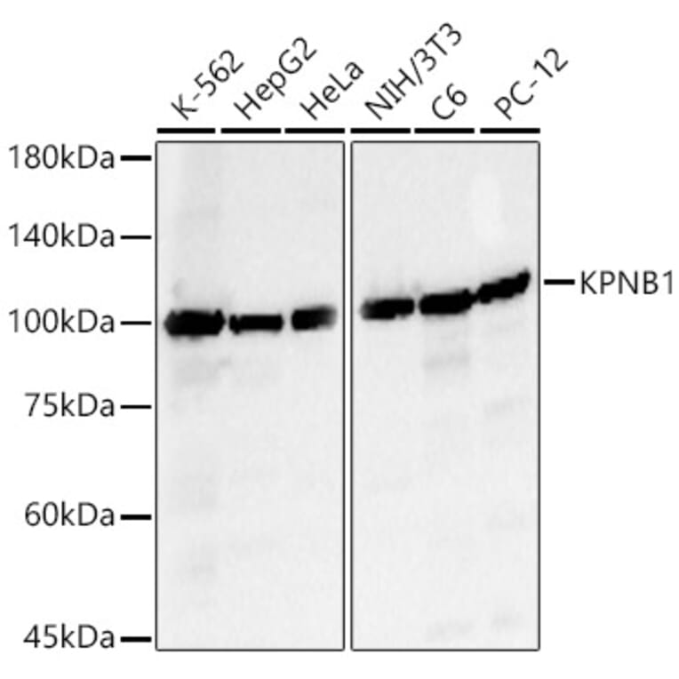 Western Blot - Anti-KPNB1 Antibody (A16248) - Antibodies.com