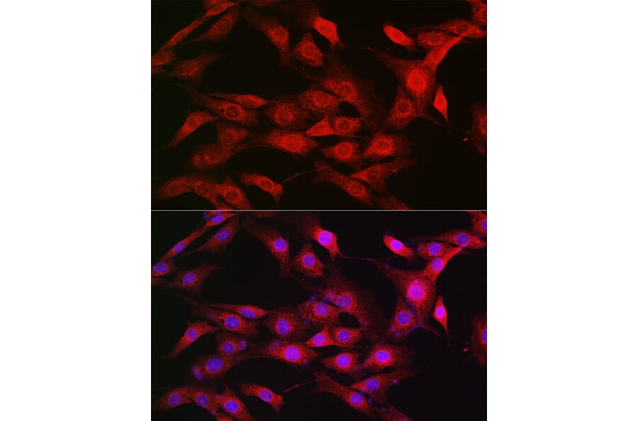 Immunofluorescence - Anti-KPNB1 Antibody (A16248) - Antibodies.com