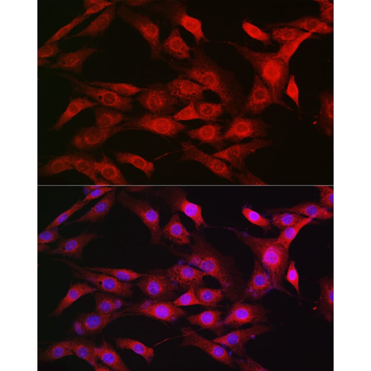 Immunofluorescence - Anti-KPNB1 Antibody (A16248) - Antibodies.com