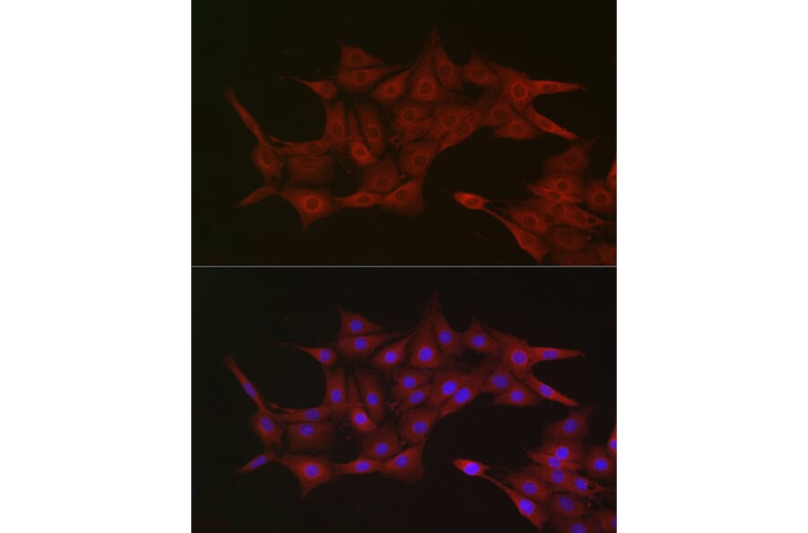 Immunofluorescence - Anti-KPNB1 Antibody (A16248) - Antibodies.com