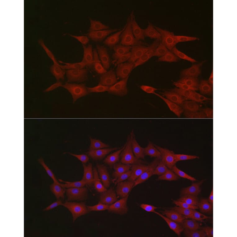 Immunofluorescence - Anti-KPNB1 Antibody (A16248) - Antibodies.com
