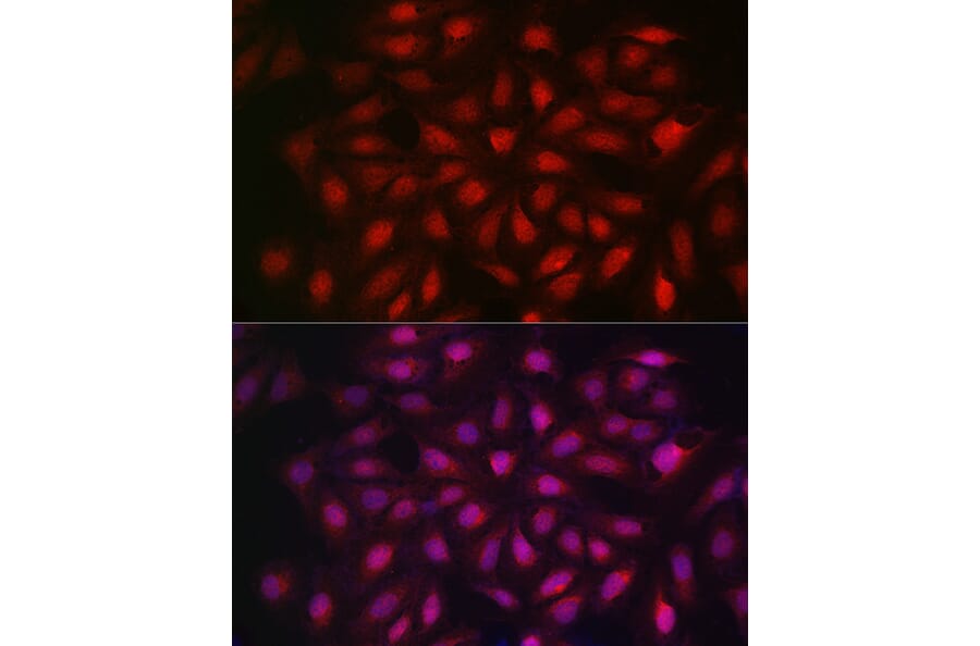 Immunofluorescence - Anti-KPNB1 Antibody (A16248) - Antibodies.com