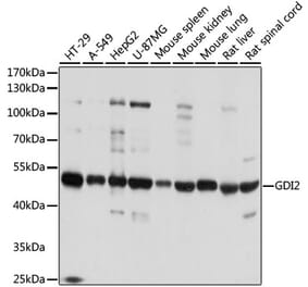 Western Blot - Anti-GDI2 Antibody (A16249) - Antibodies.com