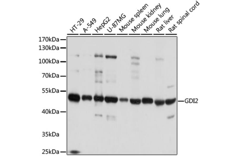 Western Blot - Anti-GDI2 Antibody (A16249) - Antibodies.com