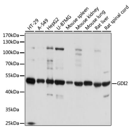 Western Blot - Anti-GDI2 Antibody (A16249) - Antibodies.com